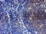 ESR1 Antibody in Immunohistochemistry (Paraffin) (IHC (P))