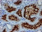 ESR1 Antibody in Immunohistochemistry (Paraffin) (IHC (P))