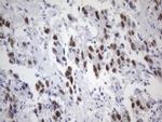 ESR1 Antibody in Immunohistochemistry (Paraffin) (IHC (P))