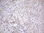 ESR1 Antibody in Immunohistochemistry (Paraffin) (IHC (P))