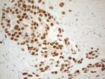 ESR1 Antibody in Immunohistochemistry (Paraffin) (IHC (P))