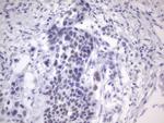 ESR1 Antibody in Immunohistochemistry (Paraffin) (IHC (P))