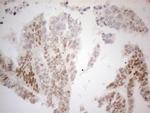 ESR1 Antibody in Immunohistochemistry (Paraffin) (IHC (P))