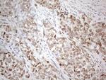 ESR1 Antibody in Immunohistochemistry (Paraffin) (IHC (P))