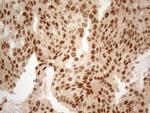 ESR1 Antibody in Immunohistochemistry (Paraffin) (IHC (P))