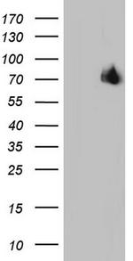 ESR1 Antibody in Western Blot (WB)