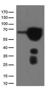 ESR1 Antibody in Western Blot (WB)