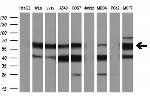 ESR1 Antibody in Western Blot (WB)