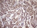 ESRRA Antibody in Immunohistochemistry (Paraffin) (IHC (P))