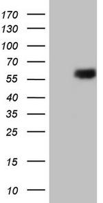 ESRRB Antibody in Western Blot (WB)