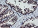 ESRRG Antibody in Immunohistochemistry (Paraffin) (IHC (P))