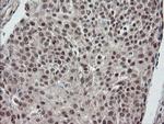 ESRRG Antibody in Immunohistochemistry (Paraffin) (IHC (P))