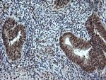 ESRRG Antibody in Immunohistochemistry (Paraffin) (IHC (P))