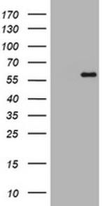 ETS2 Antibody in Western Blot (WB)