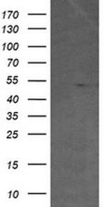 ETS2 Antibody in Western Blot (WB)