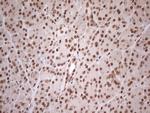 EXOSC1 Antibody in Immunohistochemistry (Paraffin) (IHC (P))