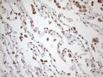 EXOSC1 Antibody in Immunohistochemistry (Paraffin) (IHC (P))