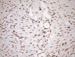 EXOSC1 Antibody in Immunohistochemistry (Paraffin) (IHC (P))