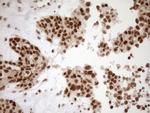 EXOSC1 Antibody in Immunohistochemistry (Paraffin) (IHC (P))