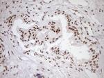 EXOSC1 Antibody in Immunohistochemistry (Paraffin) (IHC (P))