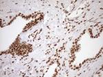 EXOSC1 Antibody in Immunohistochemistry (Paraffin) (IHC (P))