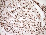 EXOSC1 Antibody in Immunohistochemistry (Paraffin) (IHC (P))