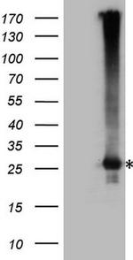 EXOSC1 Antibody in Western Blot (WB)