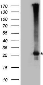 EXOSC1 Antibody in Western Blot (WB)