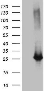 EXOSC1 Antibody in Western Blot (WB)