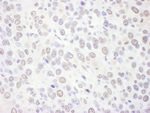 EXOSC10 Antibody in Immunohistochemistry (IHC)