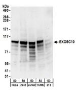 EXOSC10 Antibody in Western Blot (WB)