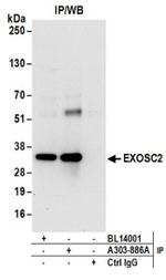 EXOSC2 Antibody in Western Blot (WB)