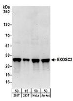 EXOSC2 Antibody in Western Blot (WB)