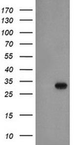 EXOSC3 Antibody in Western Blot (WB)