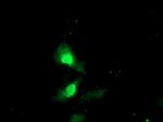 EXOSC7 Antibody in Immunocytochemistry (ICC/IF)