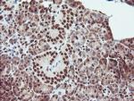 EXOSC7 Antibody in Immunohistochemistry (Paraffin) (IHC (P))