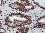 EXOSC7 Antibody in Immunohistochemistry (Paraffin) (IHC (P))