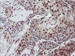 EXOSC7 Antibody in Immunohistochemistry (Paraffin) (IHC (P))