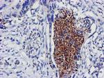 EXOSC7 Antibody in Immunohistochemistry (Paraffin) (IHC (P))