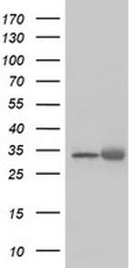 EXOSC7 Antibody in Western Blot (WB)