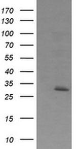 EXOSC7 Antibody in Western Blot (WB)