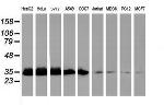 EXOSC7 Antibody in Western Blot (WB)