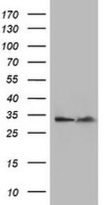 EXOSC7 Antibody in Western Blot (WB)