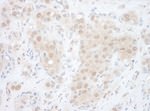 EYA2 Antibody in Immunohistochemistry (IHC)