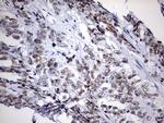 EZH2 Antibody in Immunohistochemistry (Paraffin) (IHC (P))