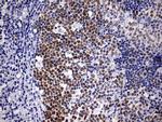 EZH2 Antibody in Immunohistochemistry (Paraffin) (IHC (P))