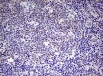 EZH2 Antibody in Immunohistochemistry (Paraffin) (IHC (P))