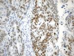 EZH2 Antibody in Immunohistochemistry (Paraffin) (IHC (P))