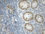 EZH2 Antibody in Immunohistochemistry (Paraffin) (IHC (P))