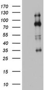 EZH2 Antibody in Western Blot (WB)